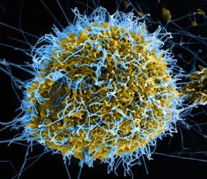  photo ebola_virus-niaid_zpsdc058c09.jpg